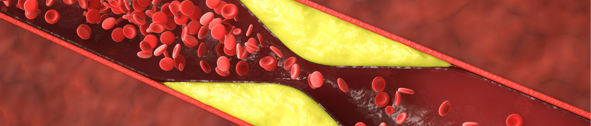 Ajurvédska liečba vysokého cholesterolu podporuje srdce