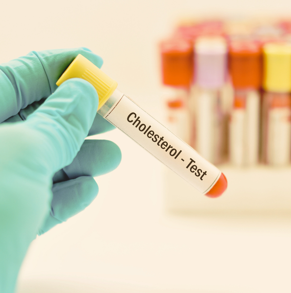 ajurvédska liečba vysokého cholesterolu bylinky